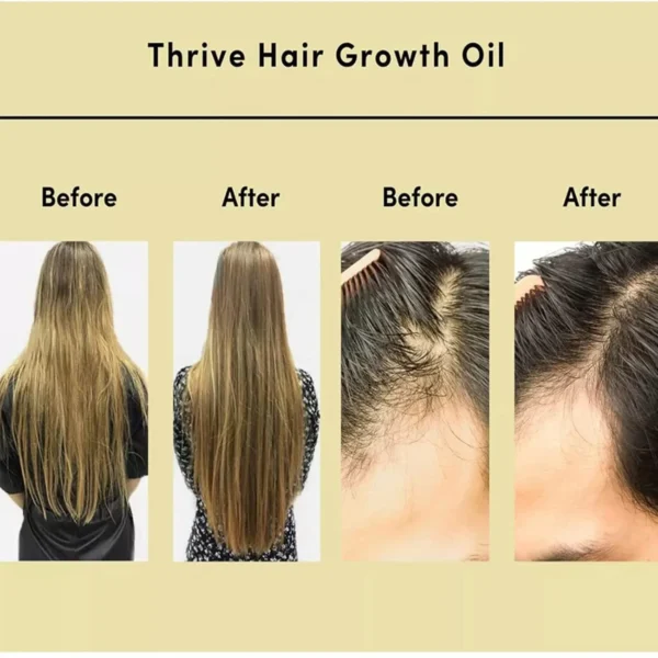 Rosemary Hair Oil – For Thin & Damaged Hair - Image 2